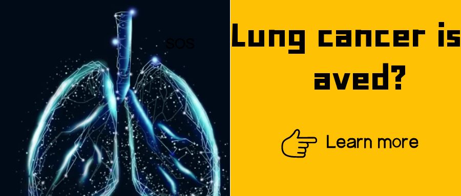 Lung cancer patients, is MRD testing necessary?