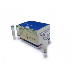 Ngwa SARS-CoV-2 Nchọpụta Nucleic Acid (Fluorescence RT-PCR)